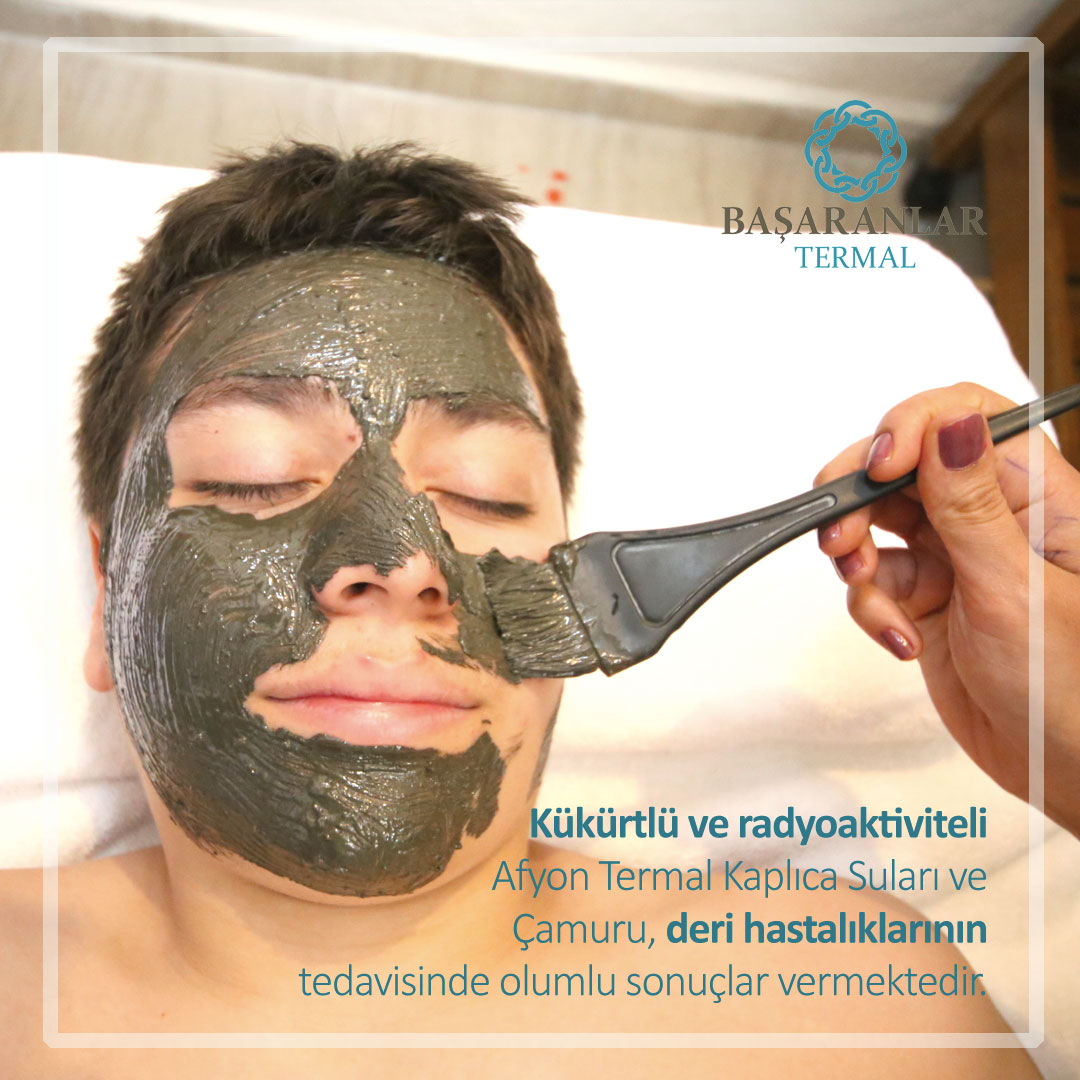 Kükürtlü ve radyoaktiviteli Afyon Termal Kaplıca Suları ve Çamuru, deri hastalıklarının tedavisinde olumlu sonuçlar vermektedir.